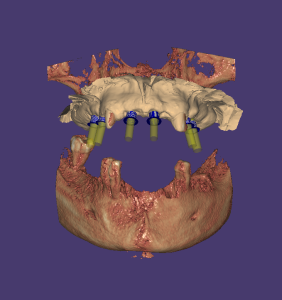 Captura Exoplan 1 282x300 Captura Exoplan 1 282x300