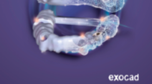 exocad 300x166 exocad 300x166